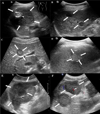 Frontiers | Conventional Ultrasound and Contrast-Enhanced
